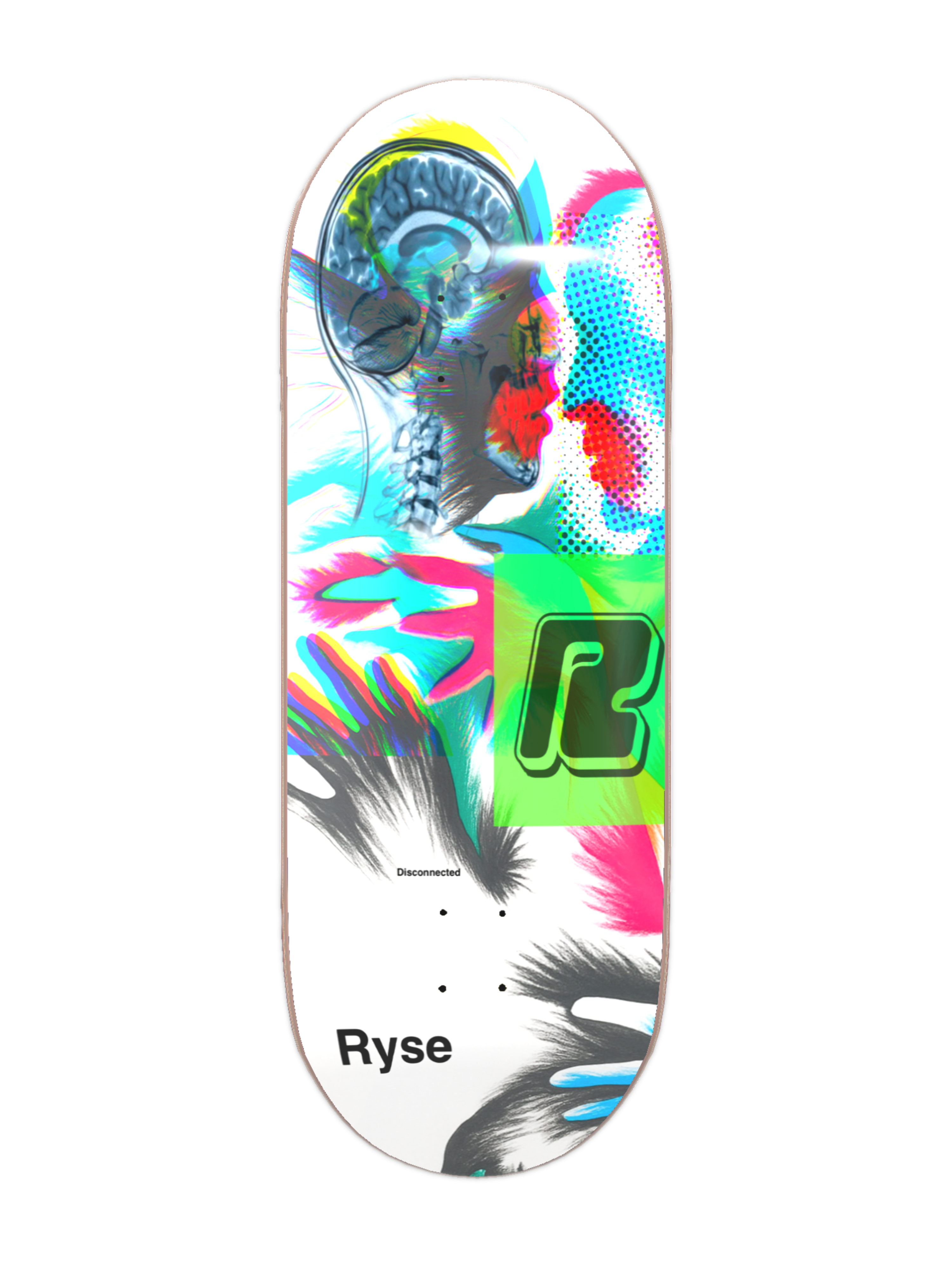 X-Ray